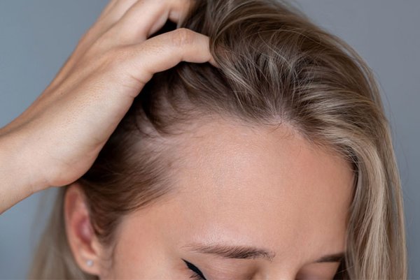 apakah rambut rontok bisa tumbuh kembali
