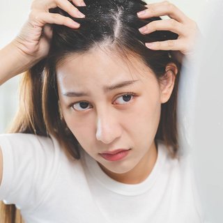 woman-with-dandruff