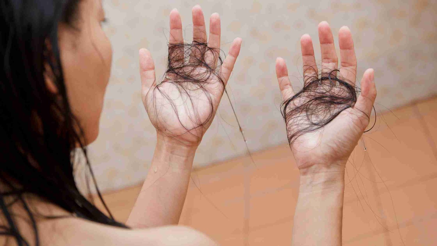 7 Cara Mengatasi Rambut Rontok Berlebihan dan Solusinya!