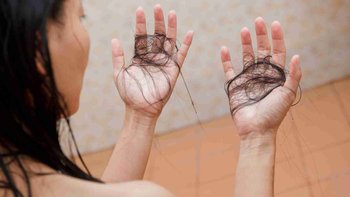Rambut Rontok Berlebihan? Begini 7 Cara Mengatasinya!