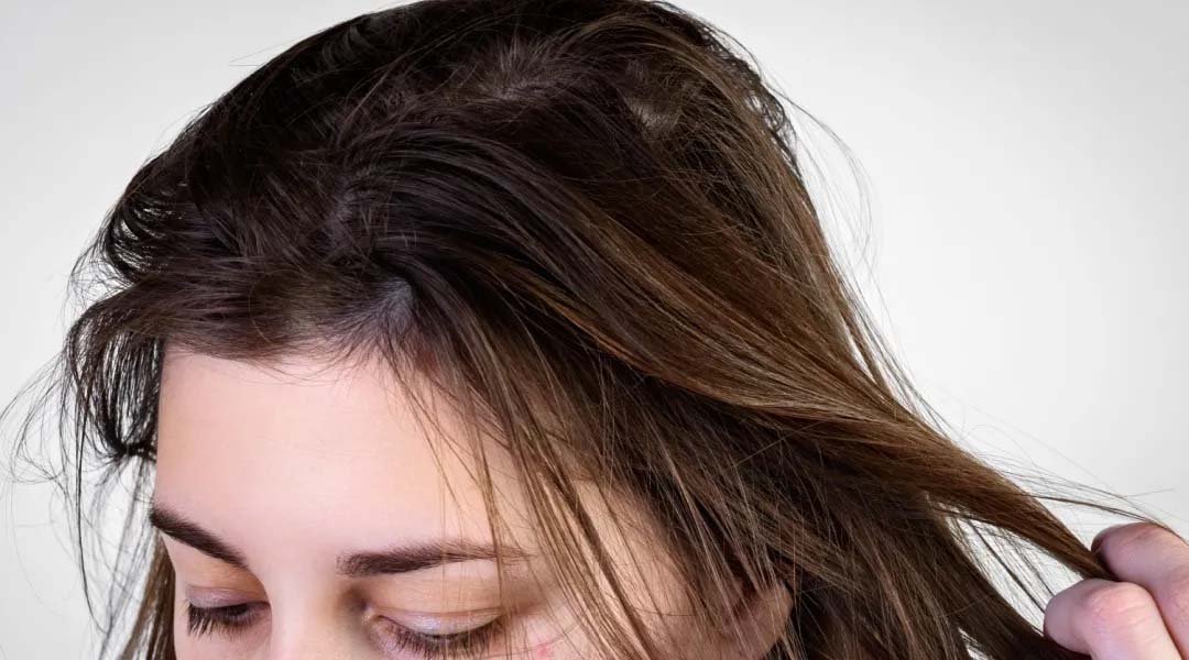 cara mengatasi rambut lepek dengan rangkaian produk Kérastase