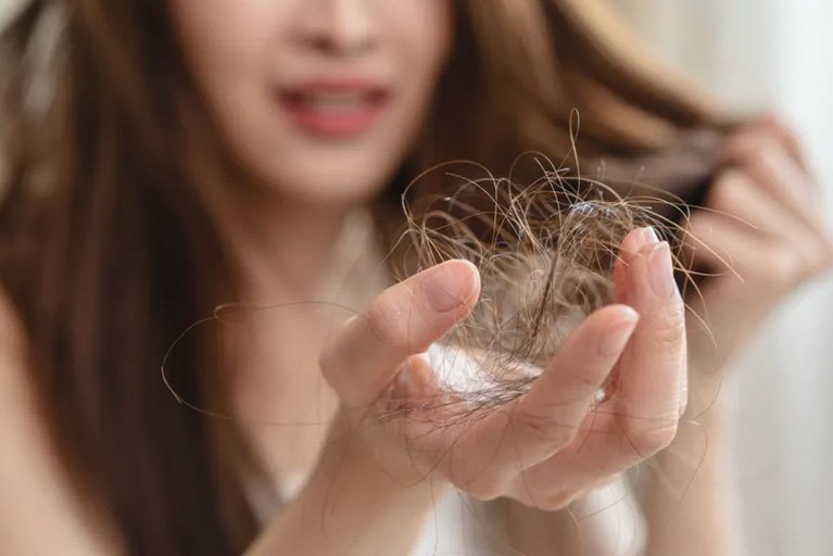 wanita memegang segumpalan rambut karena rambut patah