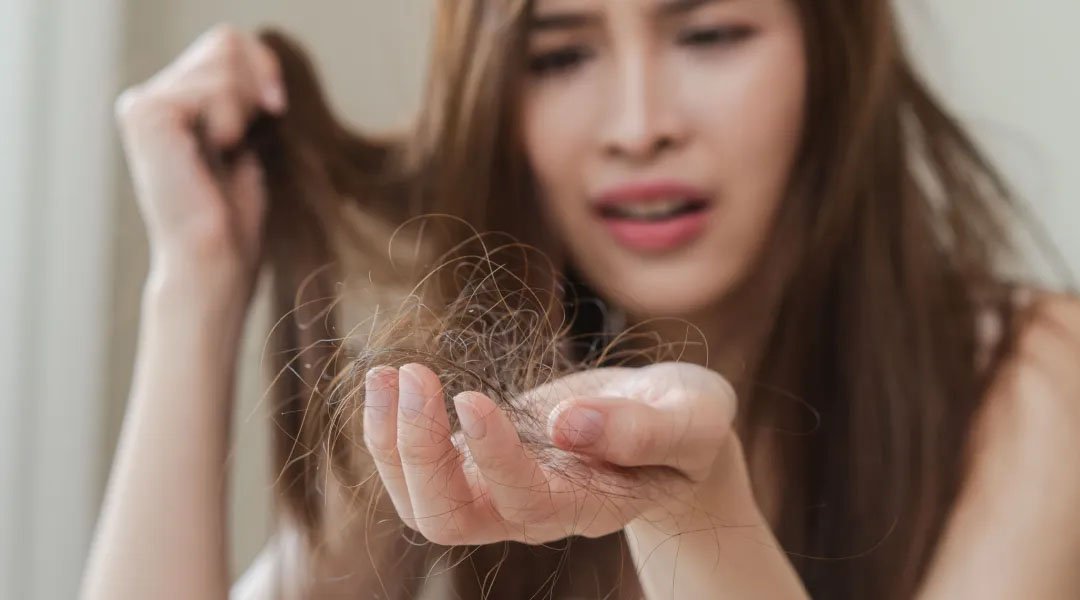 seorang wanita memegang kumpulan rambutnya karena mengalami hair fall
