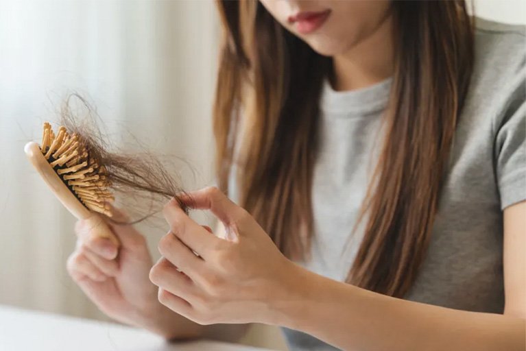 wanita memegang sisir penuh dengan rambut rontoknya meskipun sedang melakukan perawatan rambut rontok