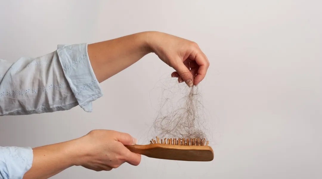 penyebab rambut rontok parah pada wanita dan pria